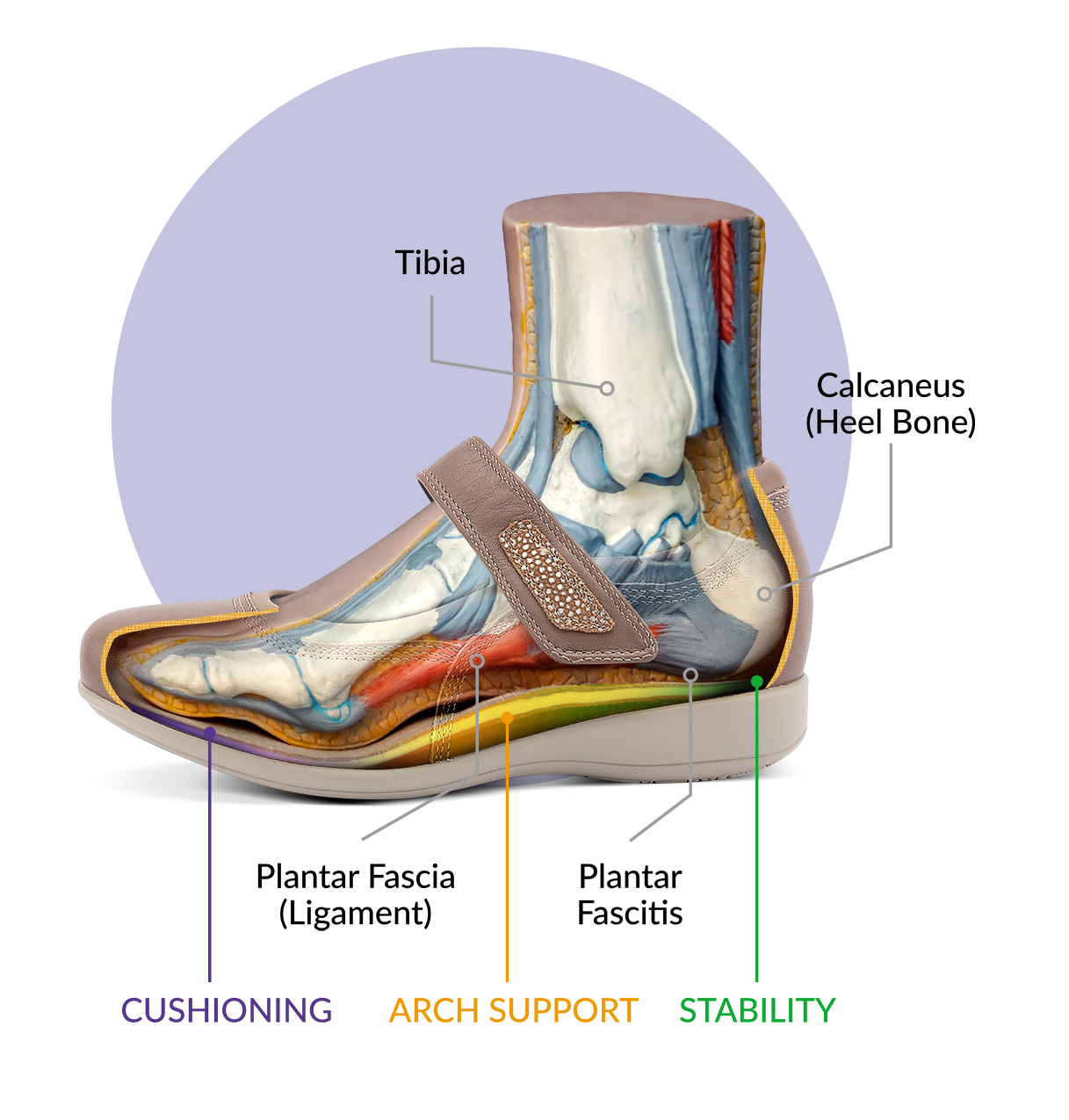 Plantitis shoes discount